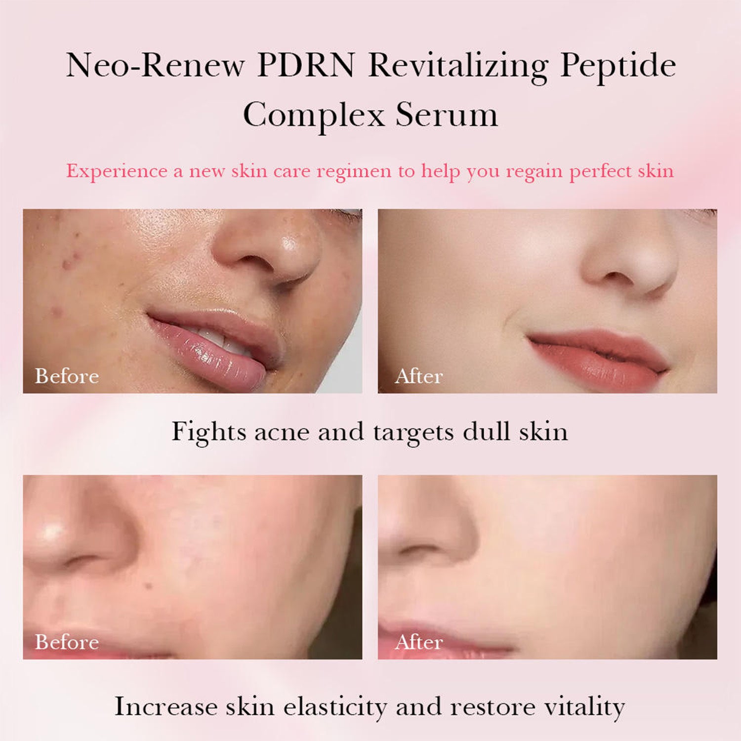 Naadea™ Hydro Surge Serum 1 oz